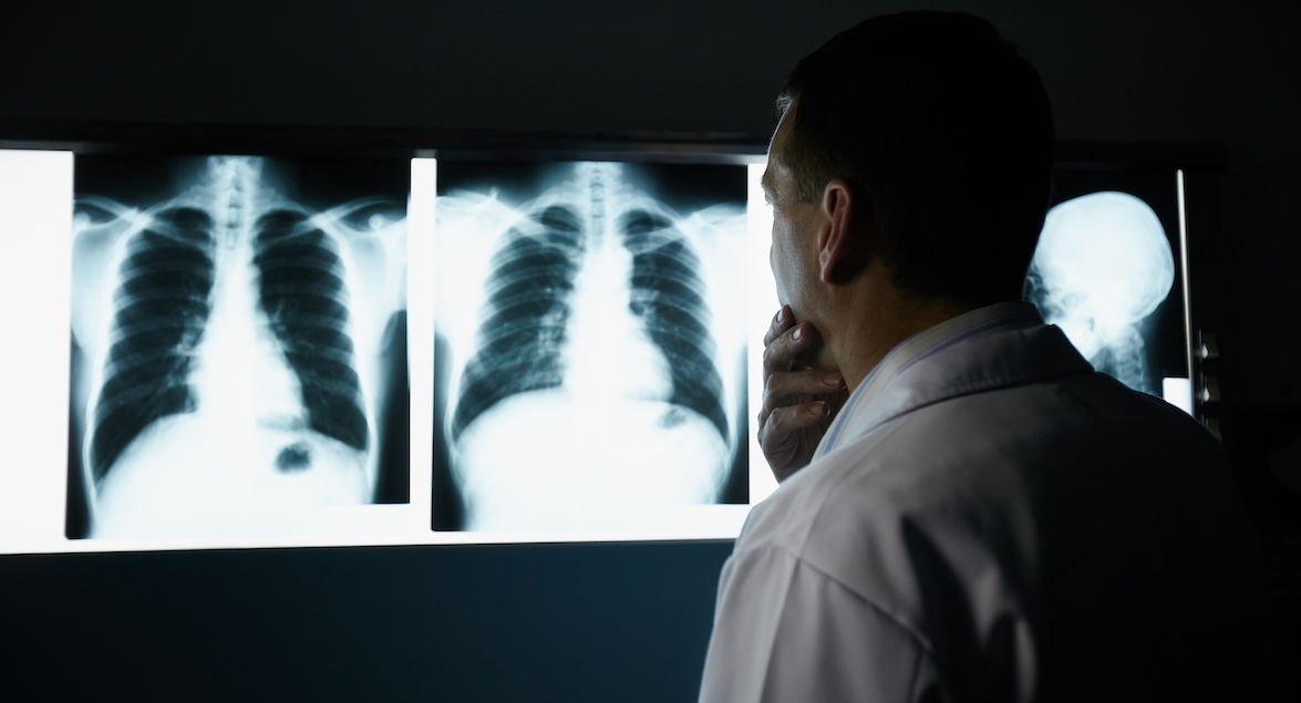Actualización para Personal Técnico en Radiología y Tomografía Computada
